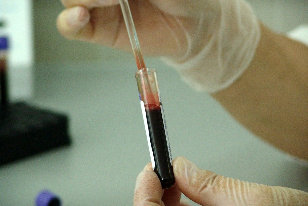 V Sloveniji je bil potrjen osmi primer okužbe s koronavirusom