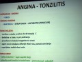 Angina - Tonzilis