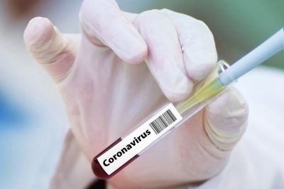Skupno število ljudi, pri katerih so do sedaj v Sloveniji potrdili okužbo s koronavirusom tako znaša 977