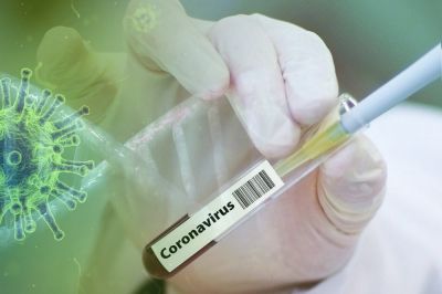Skupno število ljudi, pri katerih so do sedaj v Sloveniji potrdili okužbo s koronavirusom tako znaša 1.212