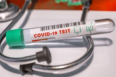 Drgi dan zapored v Sloveniji ni bilo zabeležene okužbe s koronavirusom