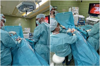 Laparoskopska operacija odstranitve ledvice