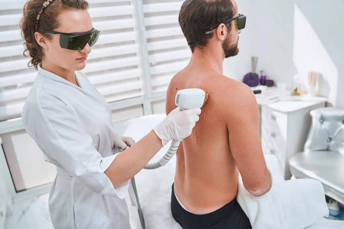 Lasersko odstranjevanje dlak