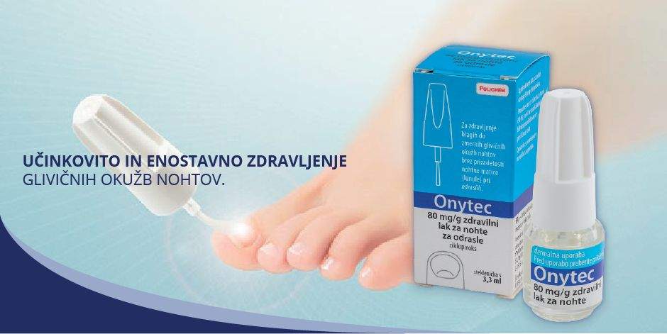 Onytec za glivice na nohtih