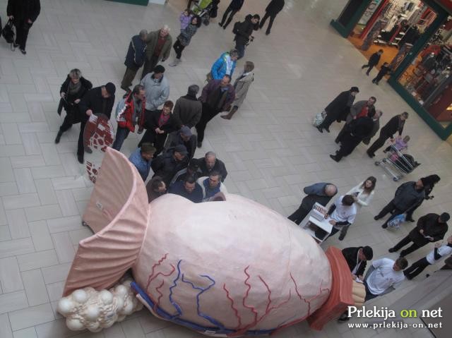 Pri ženskah najpogostejši rak dojk, pri moških pljučni rak