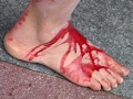 Krvava noga