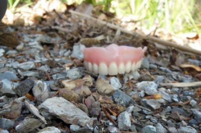 Najdena zobna proteza
